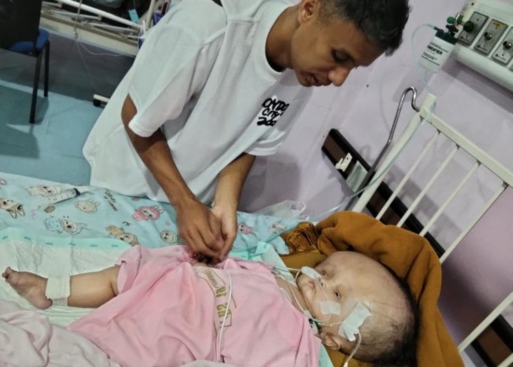 Adik Waha Berjuang Melawan Hidrosefalus di Padang